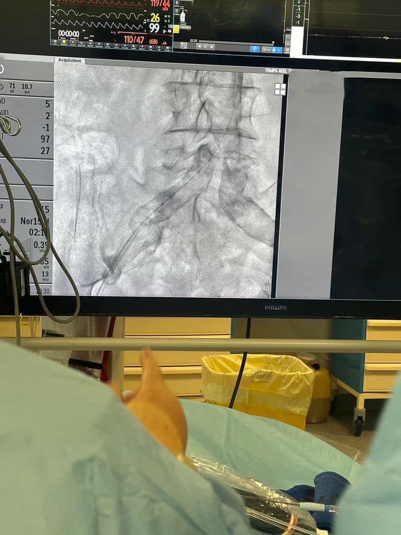 Imagerie interventionnelle